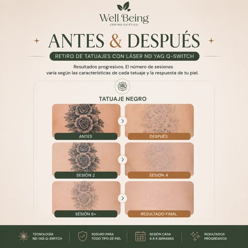 Antes y después Well-Being